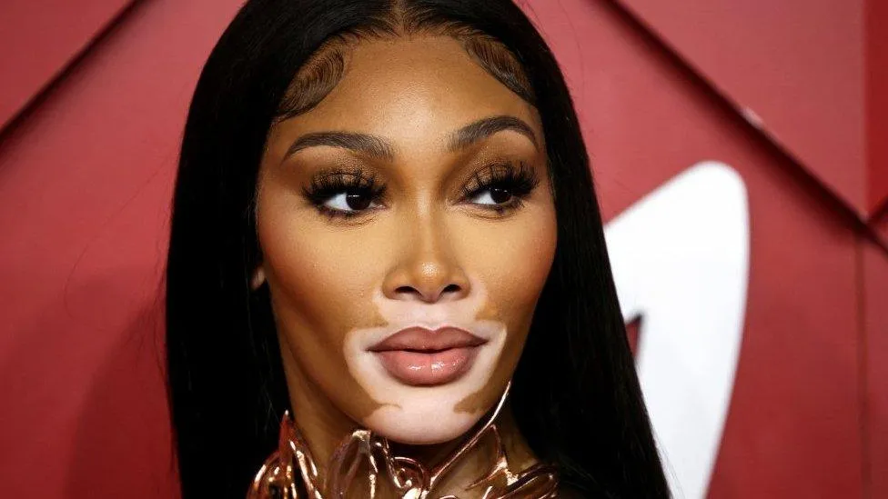 Is Vitiligo a Disability