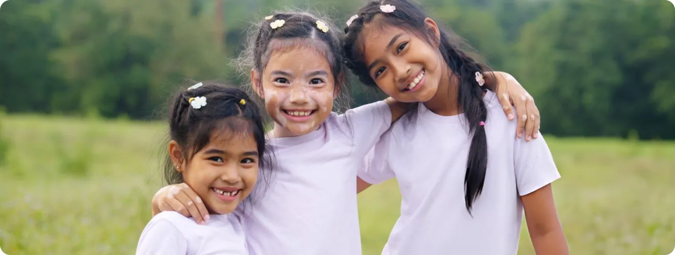 Vitiligo in Children