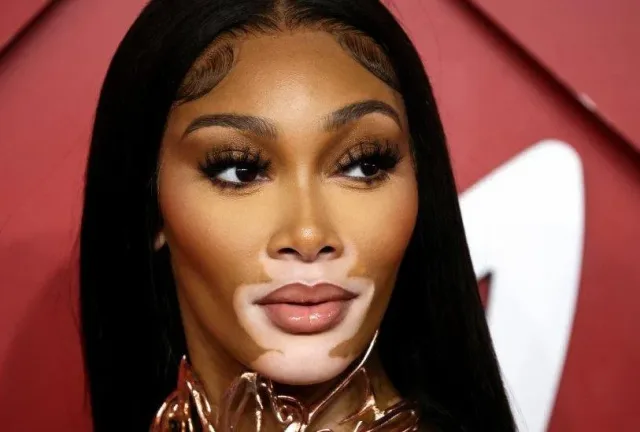 Is Vitiligo a Disability